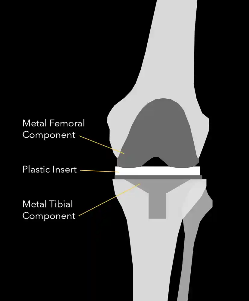 Knee with labels