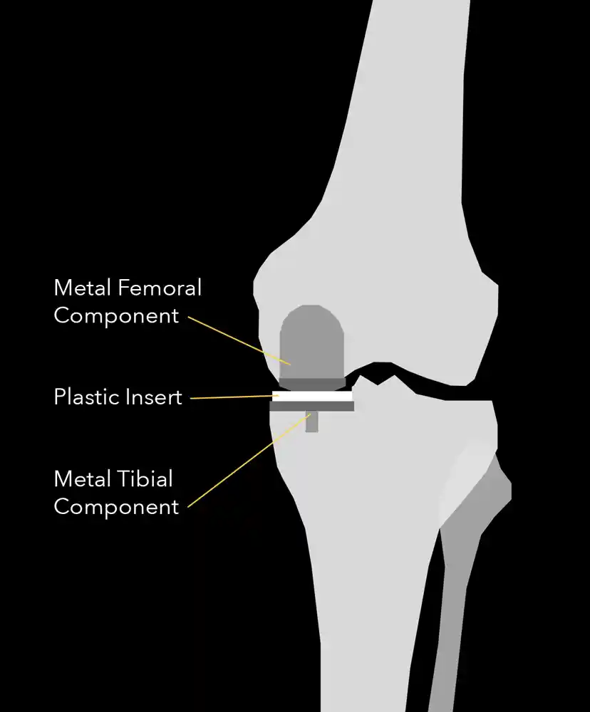 Knee with labels